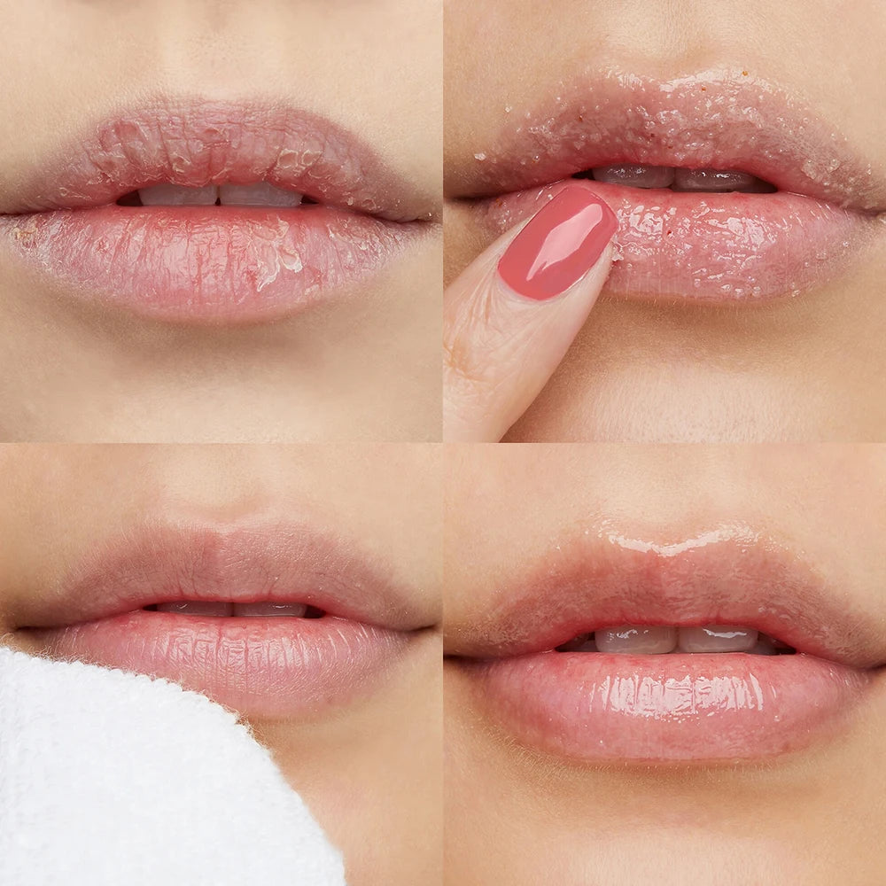 Exfoliating Lip Scrub: Moisturizing Fruit Sugar Treatment - 50g Lip Care Tidesmit