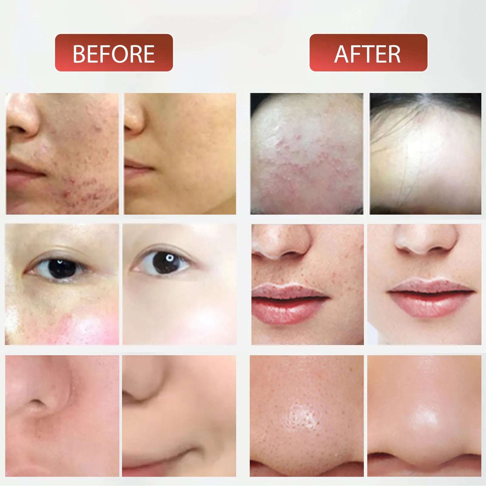 Before and after comparison of skin rejuvenation results using 7-color LED light therapy facial mask device.