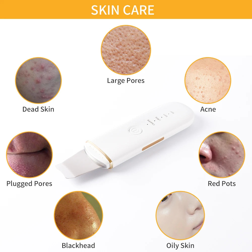 Ultrasonic Facial Skin Scrubber | Professional Deep Cleaning Spatula Scrubs Treatments Tidesmit
