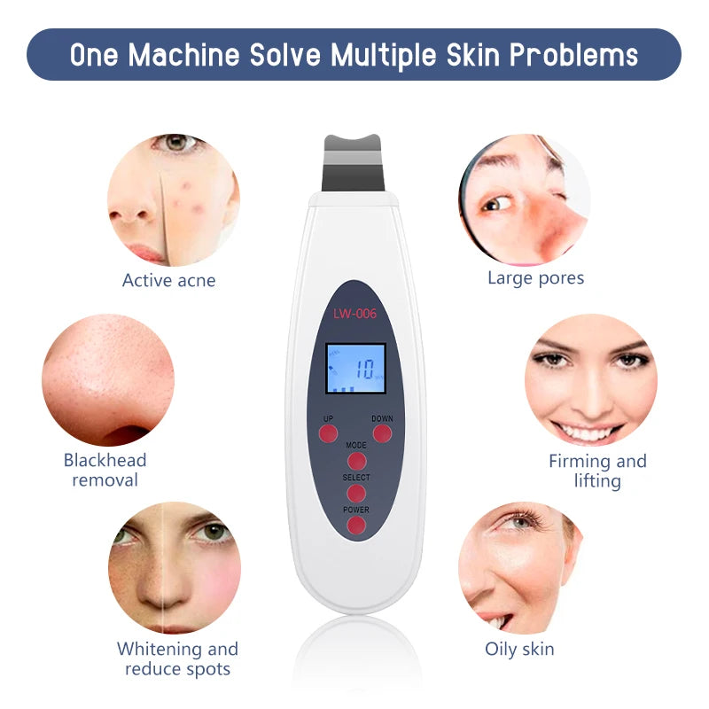 Ultrasonic Skin Scrubber - Professional Deep Pore Cleansing & Lifting Tool Scrubs Treatments Tidesmit