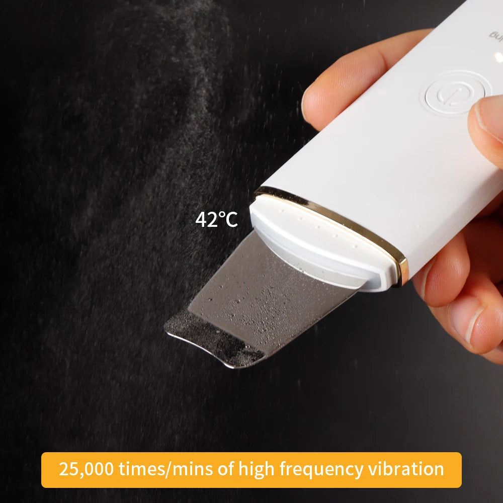 Ultrasonic Facial Skin Scrubber | Professional Deep Cleaning Spatula Scrubs Treatments Tidesmit