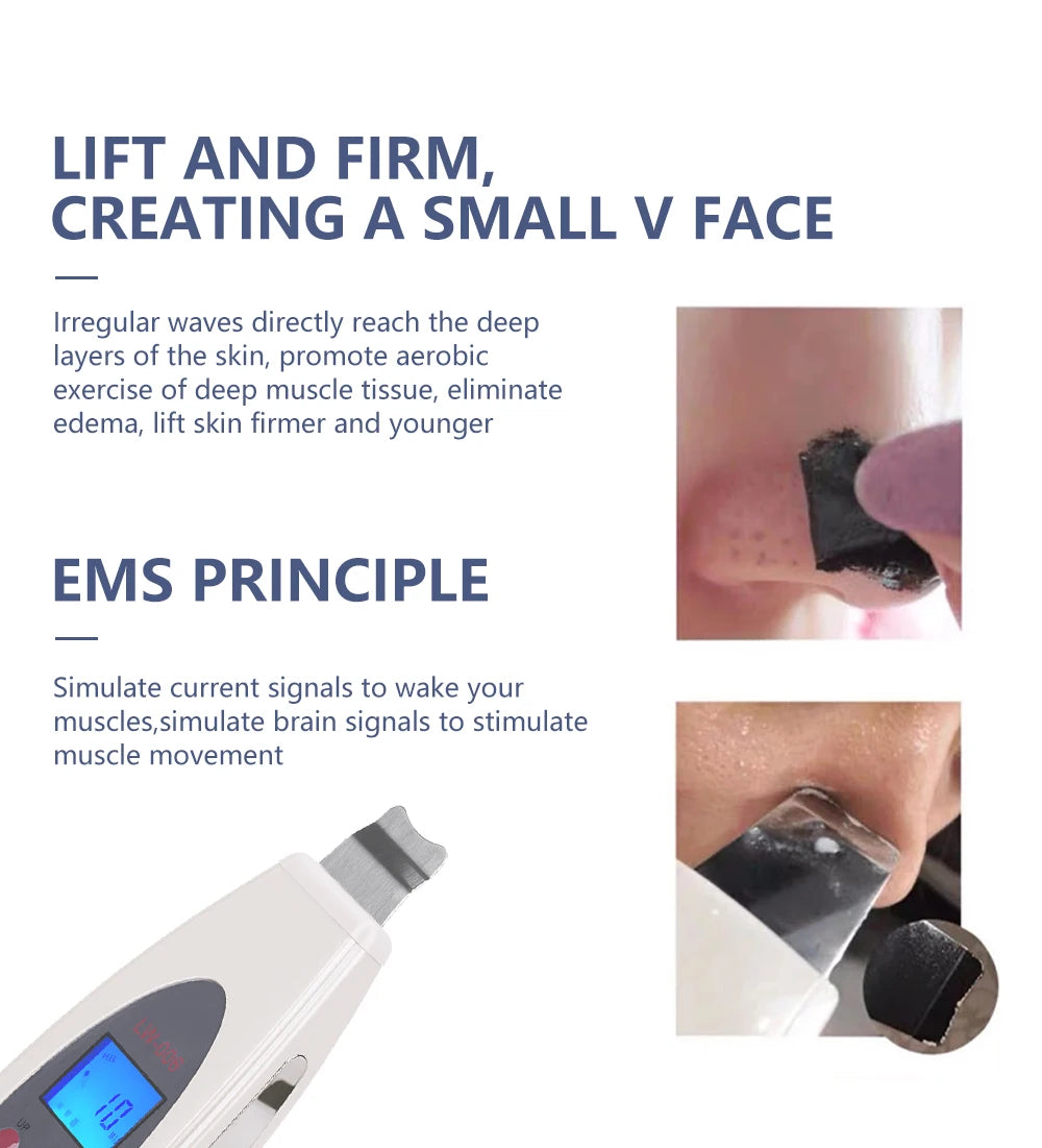 Ultrasonic Skin Scrubber - Professional Deep Pore Cleansing & Lifting Tool Scrubs Treatments Tidesmit