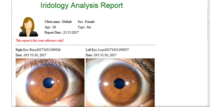 Iridology Digital Camera 12MP Professional Iris Scanner Analyzer Body Shaping Massage Equipment Tidesmit