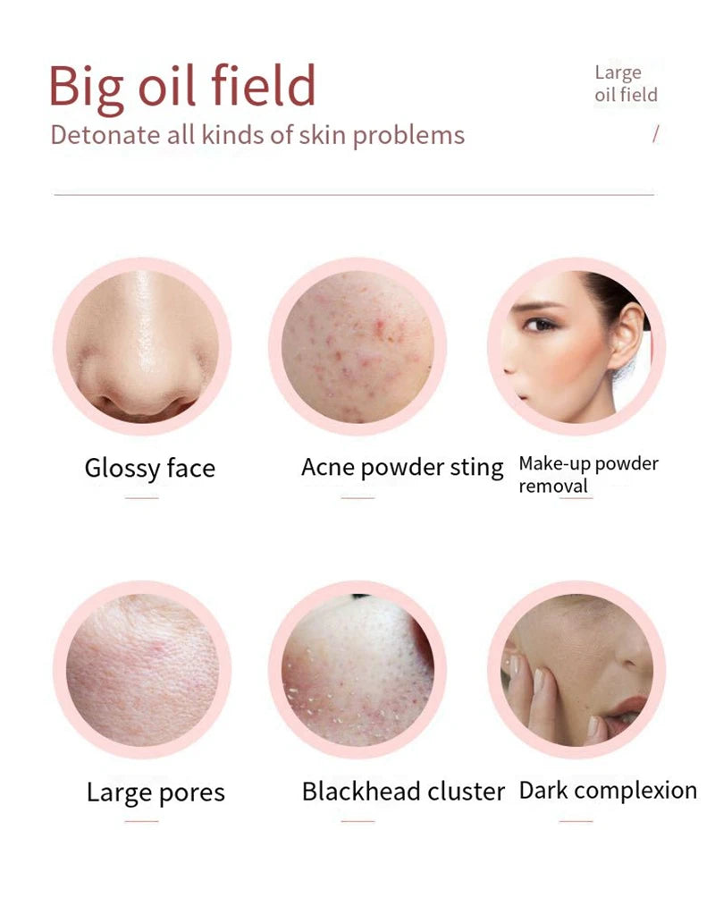 Infographic showing skin concerns like glossy skin, acne, large pores, and blackheads to promote oil-absorbing tools.