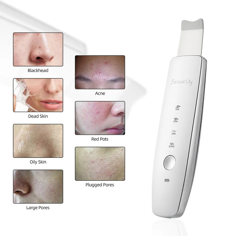Ultrasonic Facial Skin Scrubber | Professional Deep Cleaning Spatula Scrubs Treatments Tidesmit