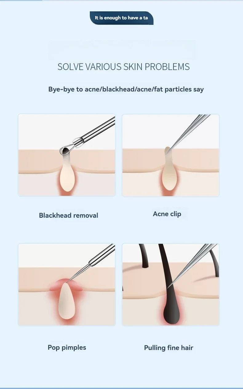 Four illustrations showing stainless steel metal tools being used to extract blackheads, acne, pimples, and fine hair.