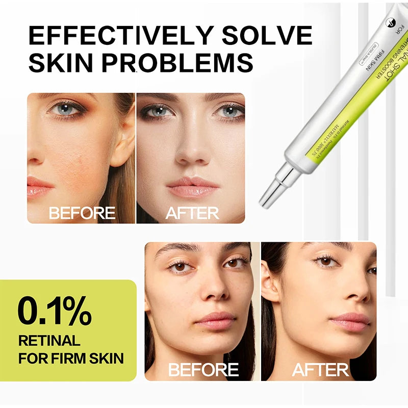 Korean Retinol Shot Eyes Tightening Moisturizing Booster Cream,Vitamin A Facial Skin Firming Lifting Care Serum,Reduce Fine Line