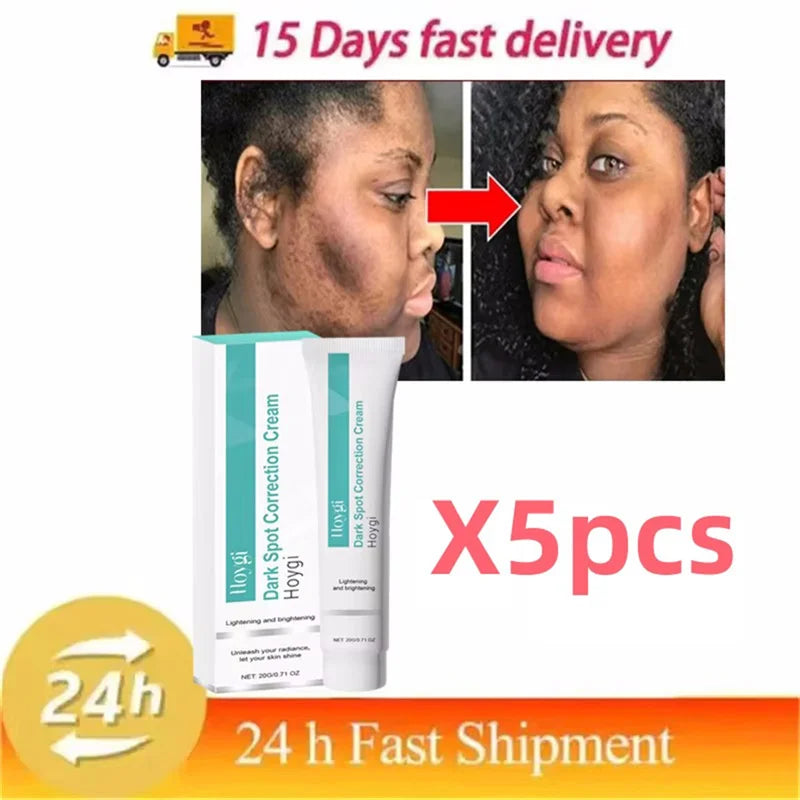 Dark Spot Corrector Cream for Pigmentation & PMU Aftercare | Tidesmit Permanent Makeup Machines 5pc Tidesmit