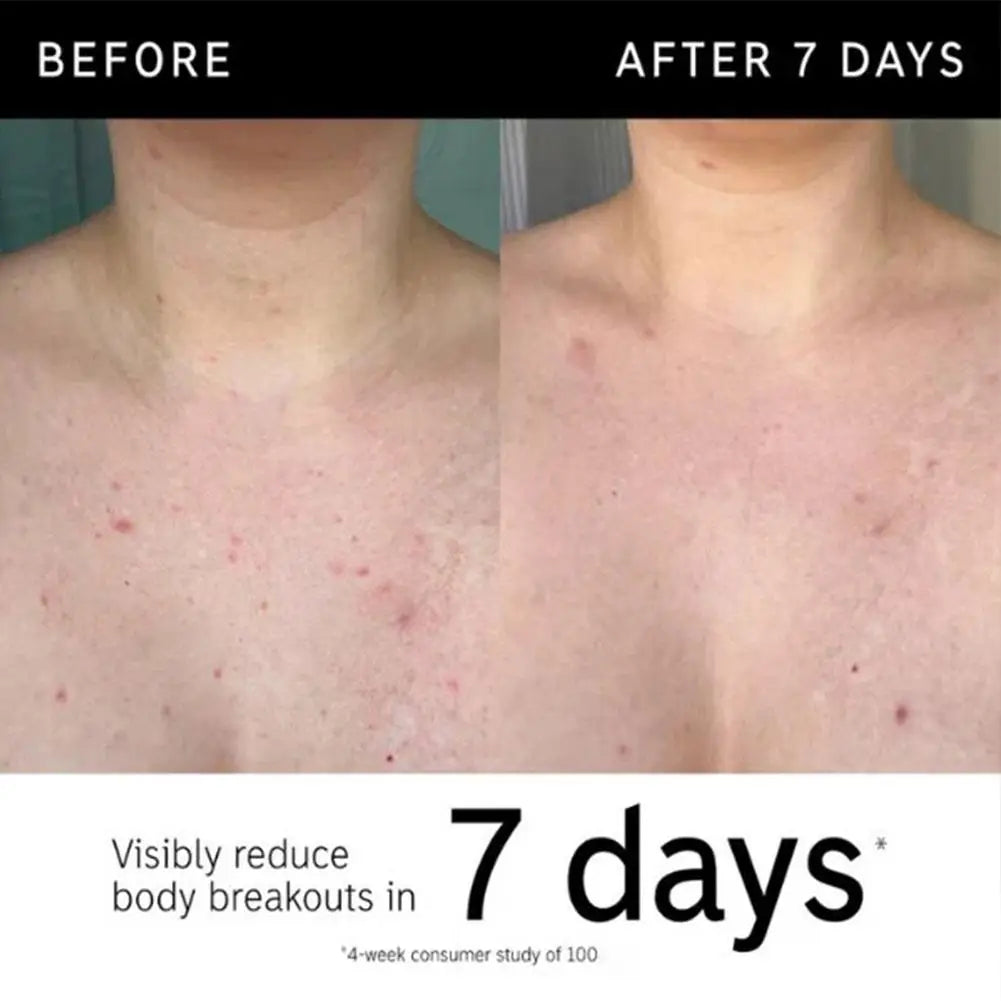 Glycolic Acid Exfoliating Stick | Cruelty-Free Face Treatment Scrubs Treatments Tidesmit