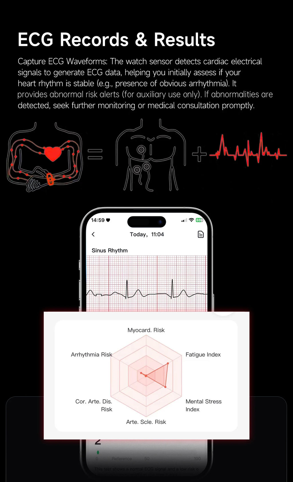 ECG Health Smart Bracelet 2026 New HRV Monitor Fitness Tracker Wristband Sport Band Waterproof No Screen Smartwatch Women Men