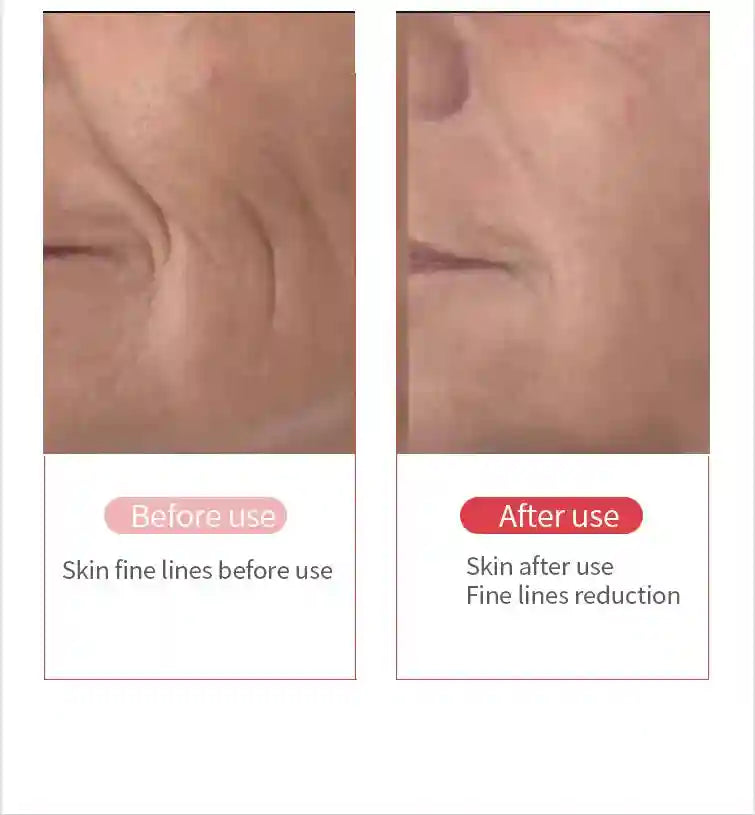 RF Skin Tightener Facial Massager | Ultrasonic Wrinkle Tool with Heat Eye Massage Instrument Tidesmit