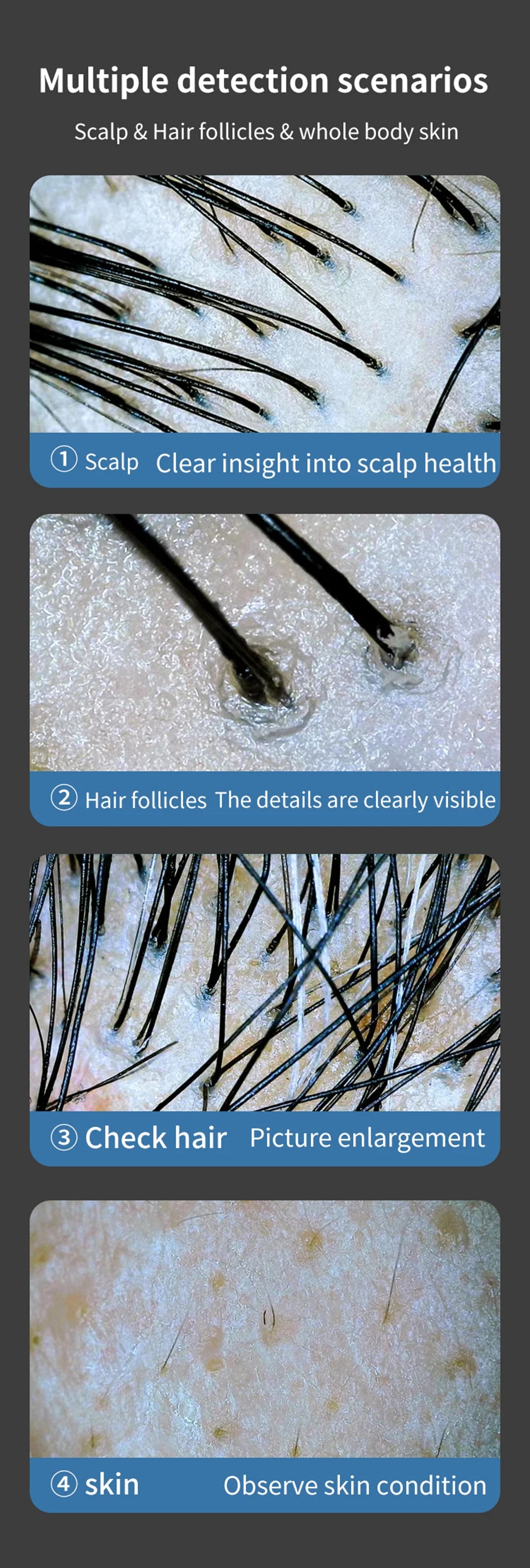 HD scalp and skin analyzer showing magnified views of hair follicles and skin texture for professional testing.