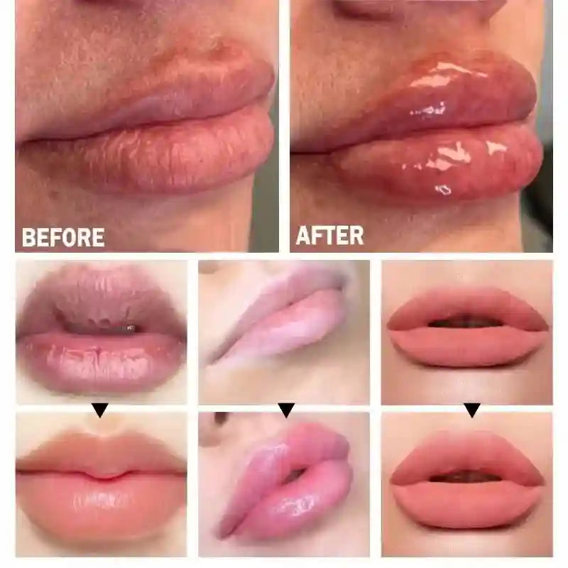 Lip Plumper Serum - Hydrating Anti-Wrinkle Treatment by Tidesmit Lip Care Tidesmit
