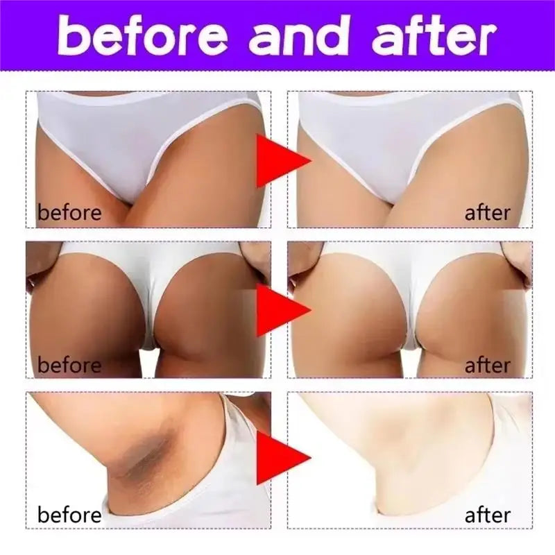 Body Whitening Cream Private Parts Underarm Dark Skin Bleaching Serum Niacinamide Whitening Lighten Dark Spots Snow Bleach Cream