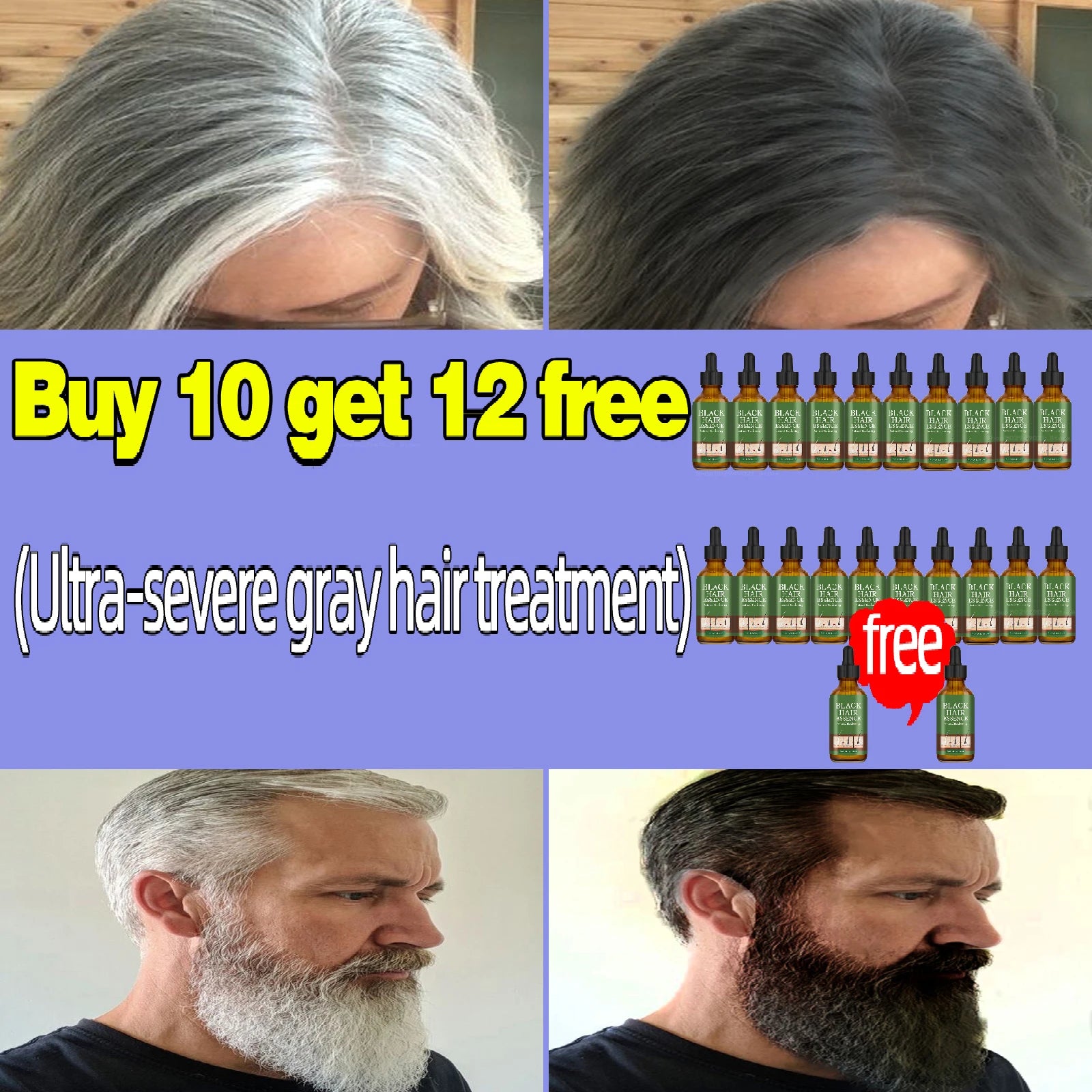 Anti Gray Hair Serum – Natural Scalp Nourishing Darkening Care Lip Care 22 pcs Tidesmit