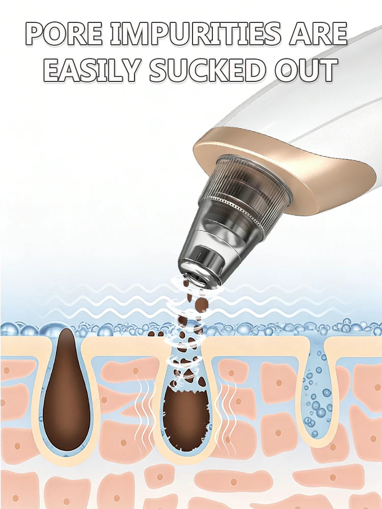 White and gold blackhead vacuum remover tool for deep pore cleansing and acne extraction, shown in cross-section view.
