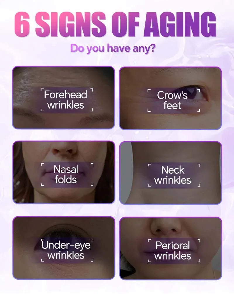 Educational chart showing six facial areas prone to wrinkles: forehead, eyes, nasal folds, neck, and mouth.