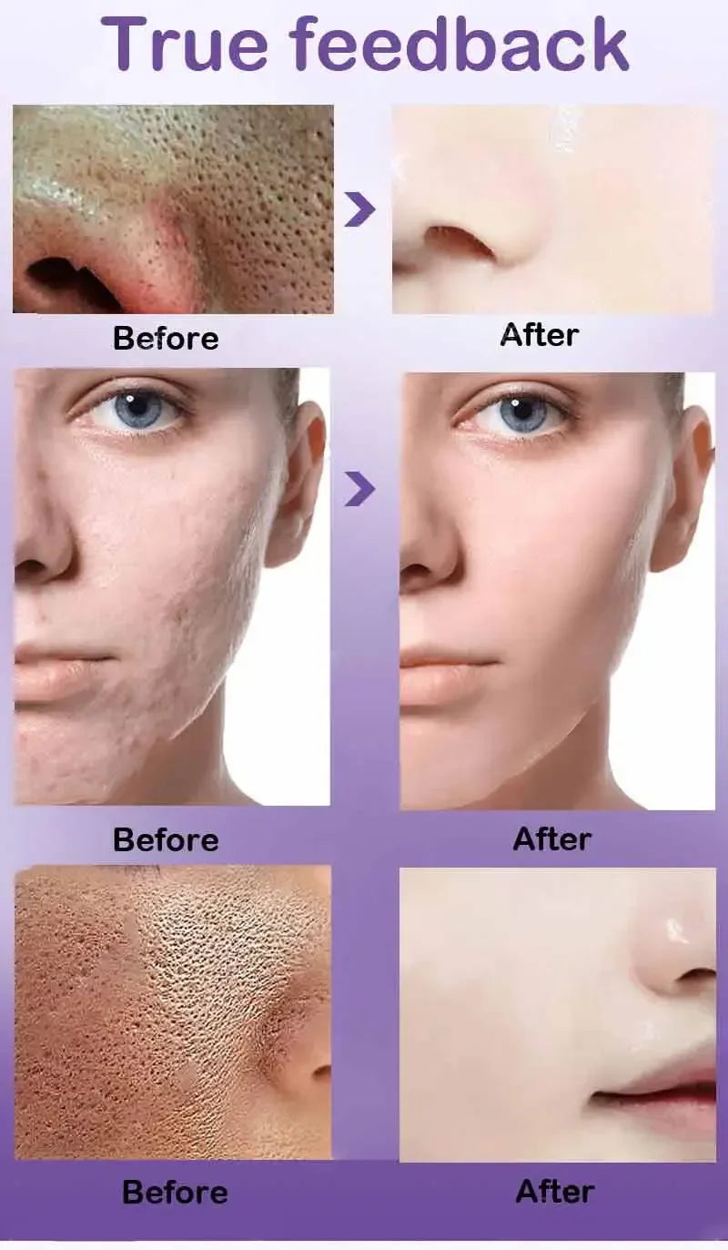 Retinol Niacinamide Serum - Professional PMU Machine Pore Refining Permanent Makeup Machines Tidesmit