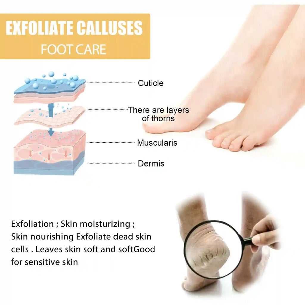 Foot Exfoliating Spray | Professional Callus Remover & Moisture Lock Scrubs Treatments Tidesmit