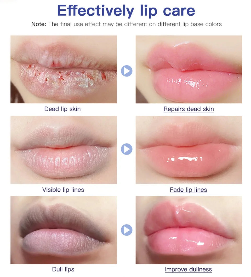 Lip Repair Gel: Instant Moisturizing Balm for Dry Lips - 2 Pack Lip Care Tidesmit