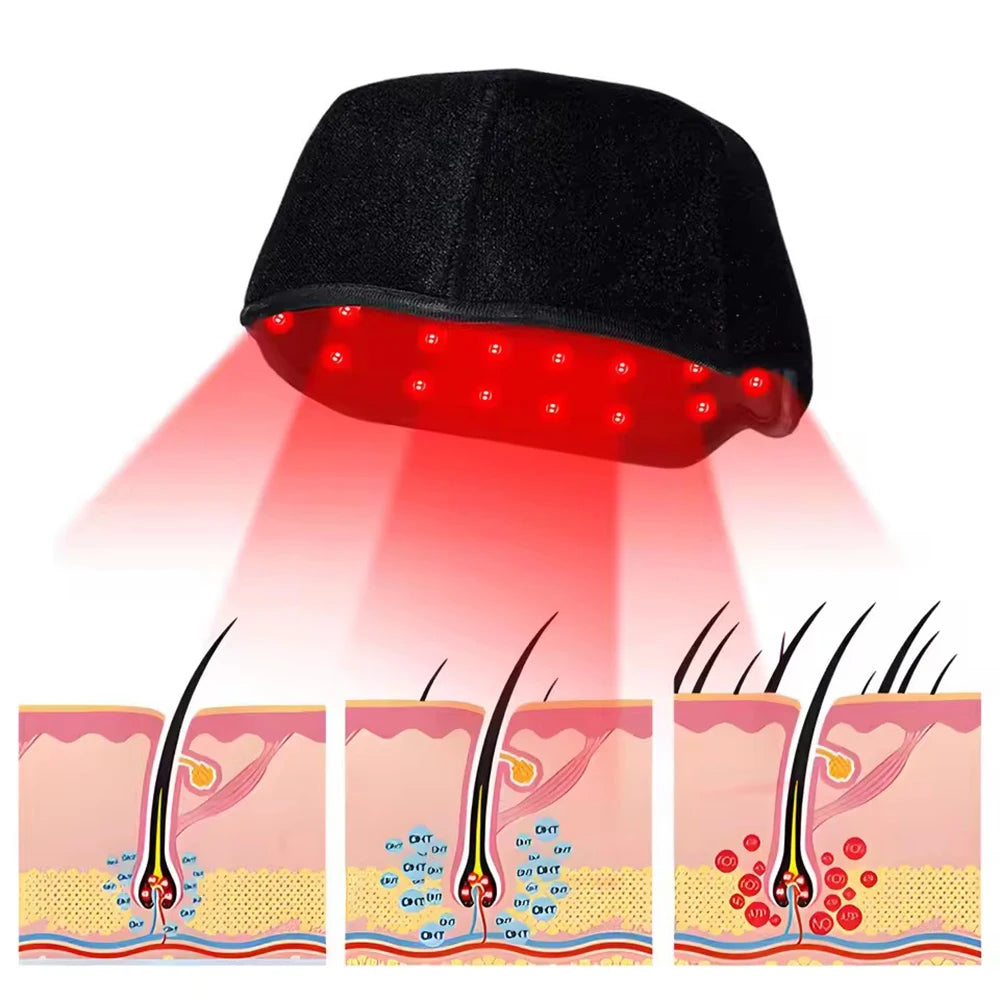 660nm 850nm Red & Infrared Light Hair Growth Cap, USB Charging Red Light Therapy Device Hair Loss Treatment Hair Regrowth Helmet