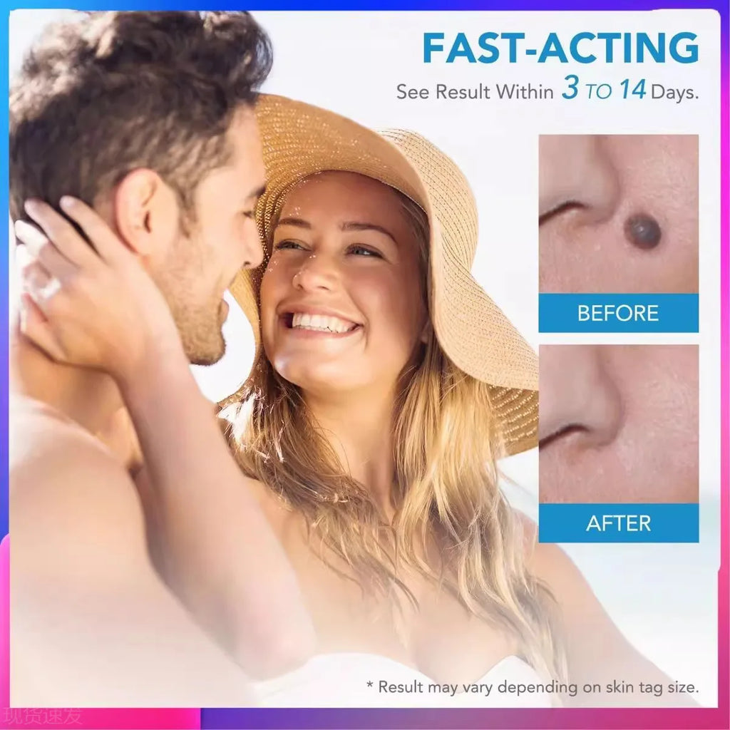 2-in-1 painless skin tag and mole removal kit showing fast-acting before and after results on facial skin.