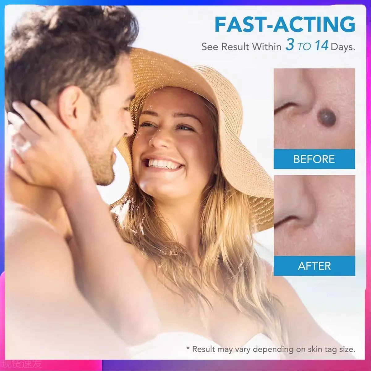 2-in-1 painless skin tag and mole removal kit showing fast-acting before and after results on facial skin.
