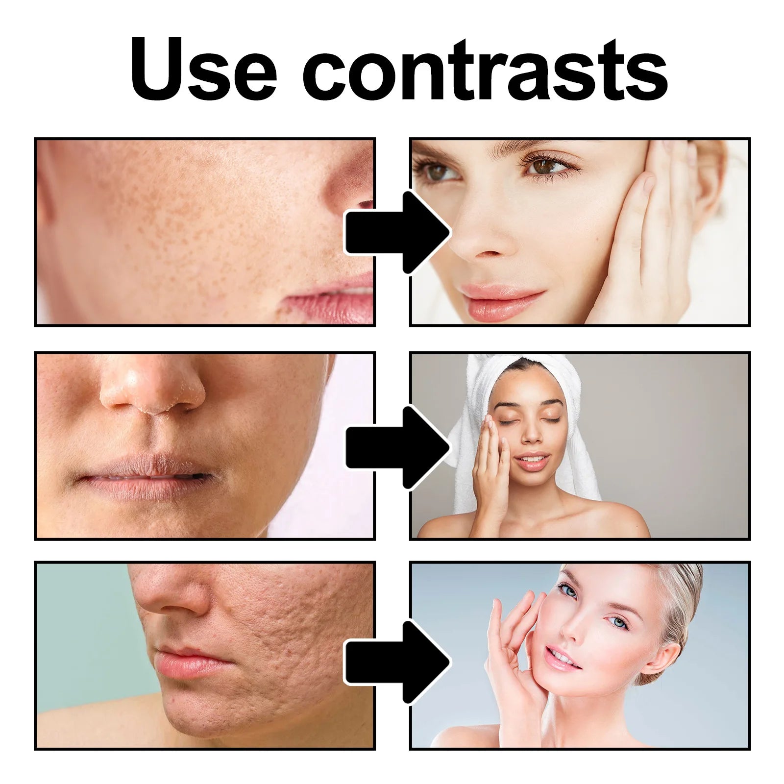 Exfoliating Peeling Gel for Acne and Blackheads - 50g Gentle Formula Scrubs Treatments Tidesmit