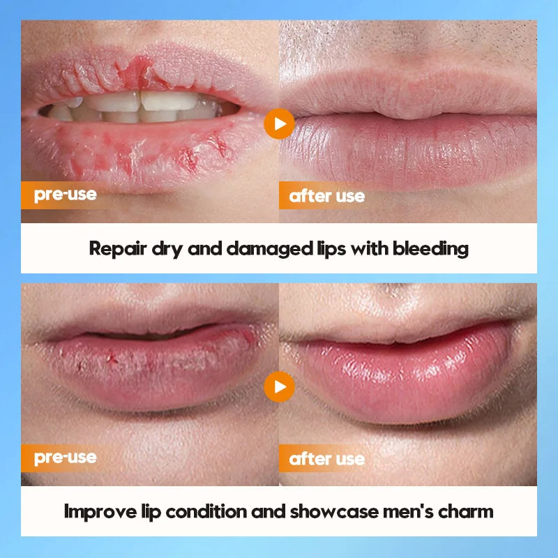 Mens Lip Treatment Balm - Moisturizing Vitamin E Repair by Tidesmit Lip Care Tidesmit
