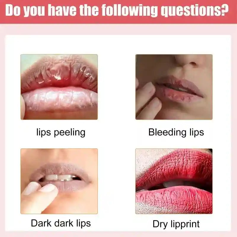 Pink Lip Lightening Serum for Dark Lips - Moisturizing Lip Care Lip Care Tidesmit
