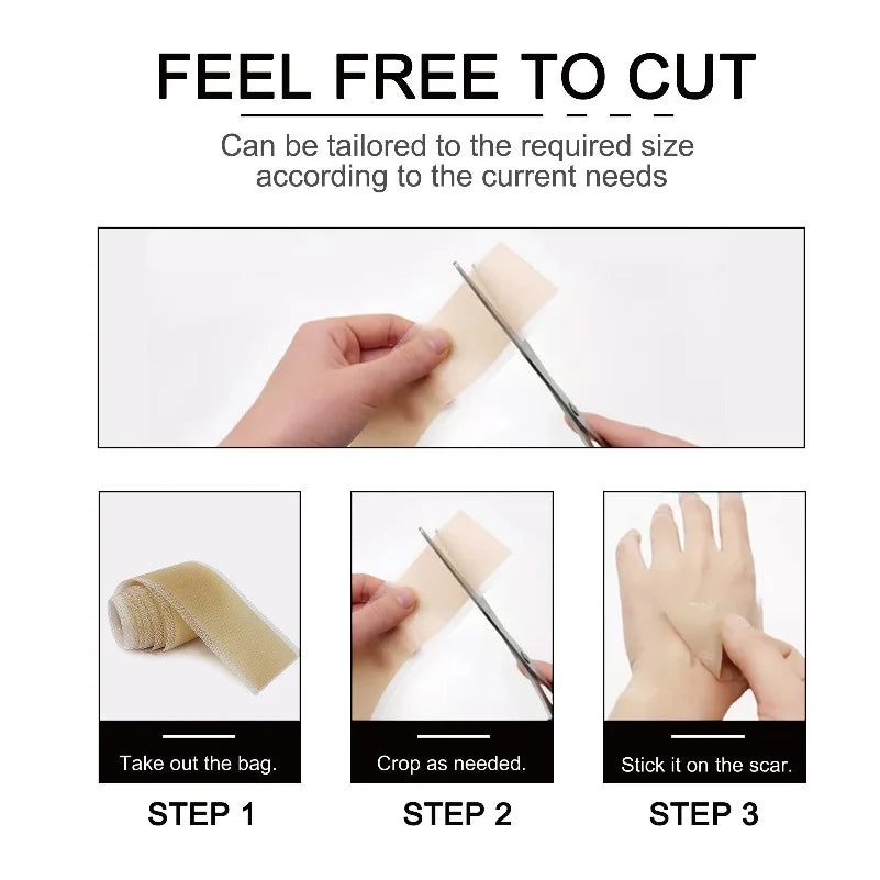 1 Roll = 4cm x 1.5m Silicone Scar Sheets , Self-Adhesive Scar Cover Tape , Reusable Skin Care Strips