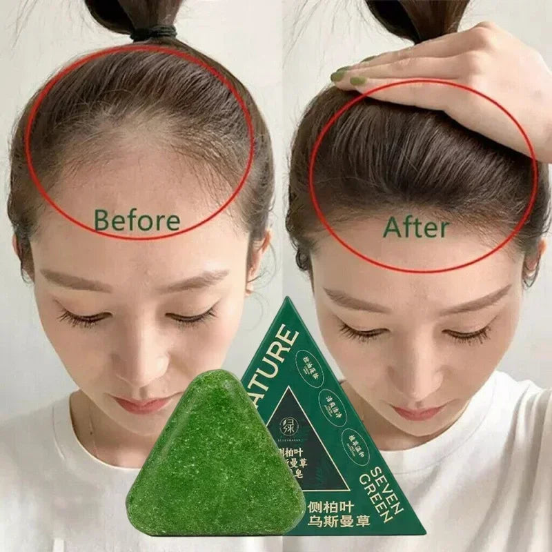 Oriental Arborvitae Leaf Shampoo Soap Relieves Scalp Itching Strengthens Hair Root Oil Control Anti-dandruff New Natural Shampoo