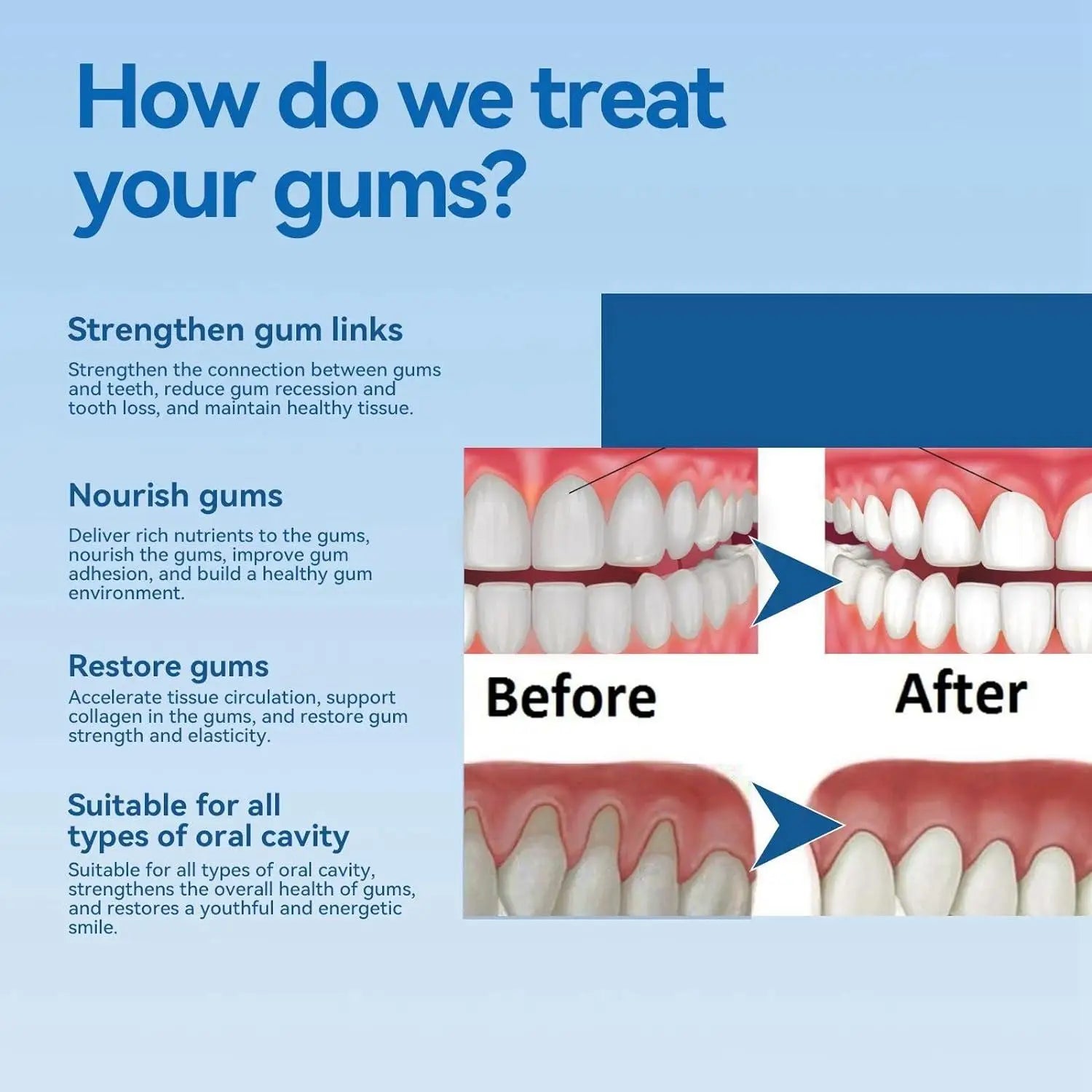 Tidesmit 50ml teeth whitening serum for gum repair, tooth allergy relief, and dental caries prevention.