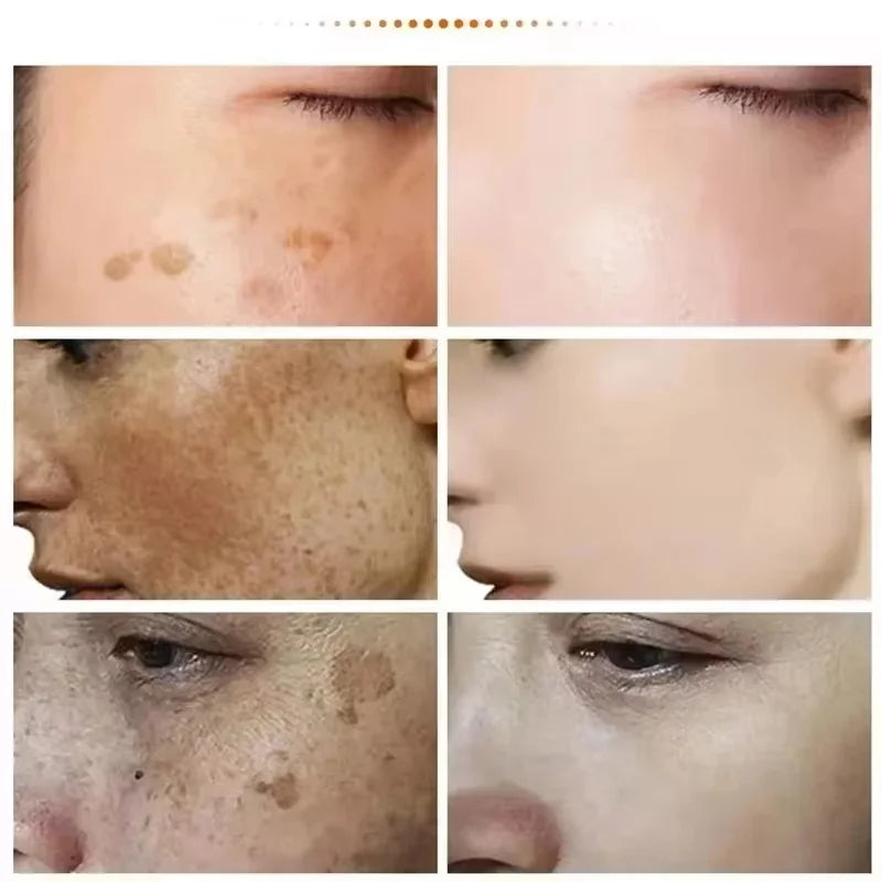 Dark Spot Corrector Cream for Pigmentation & PMU Aftercare | Tidesmit Permanent Makeup Machines Tidesmit