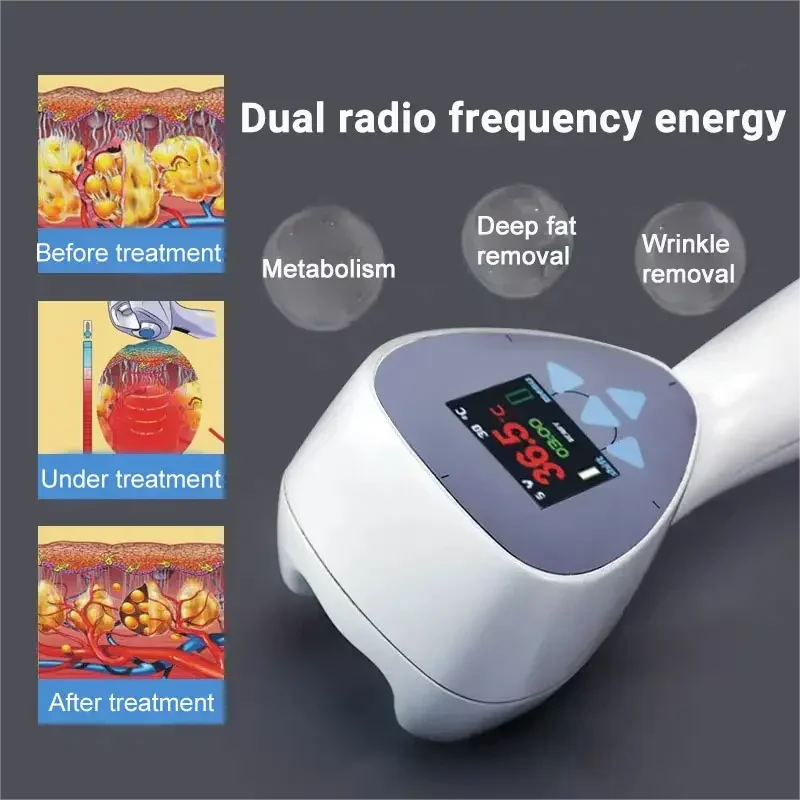 Professional Skin Tightening Machine for Face Lifting and Fat Removal Relaxation Treatment Tidesmit