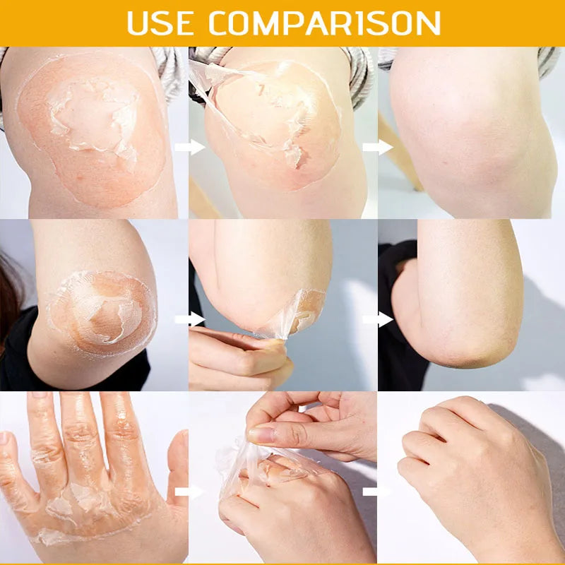 Yellow Peeling Oil for Dark Skin - Professional Exfoliating Treatment Scrubs Treatments Tidesmit