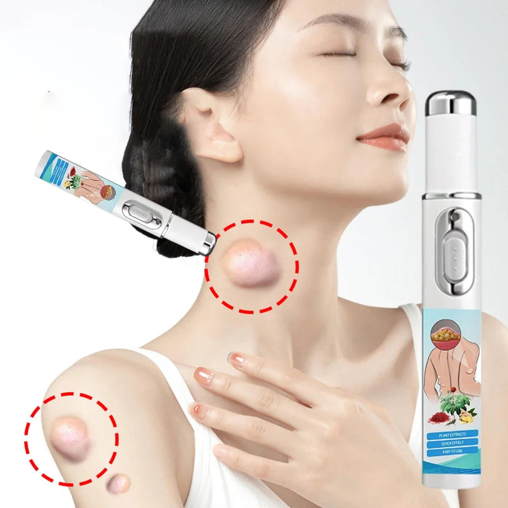 Lipoma Removal Laser Device for Subcutaneous Lumps - Tidesmit Lip Care Tidesmit