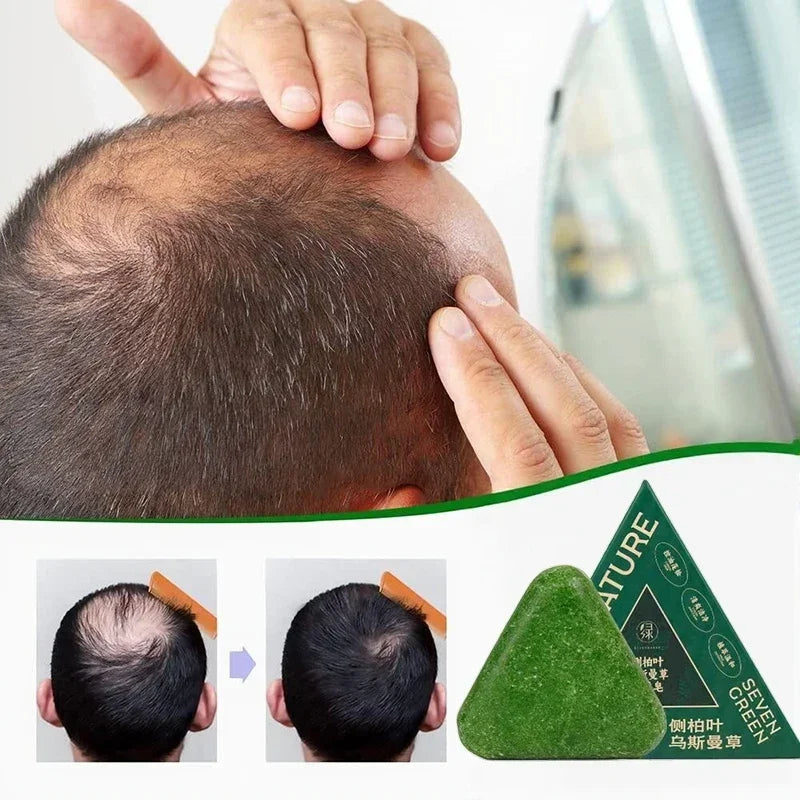 Oriental Arborvitae Leaf Shampoo Soap Relieves Scalp Itching Strengthens Hair Root Oil Control Anti-dandruff New Natural Shampoo