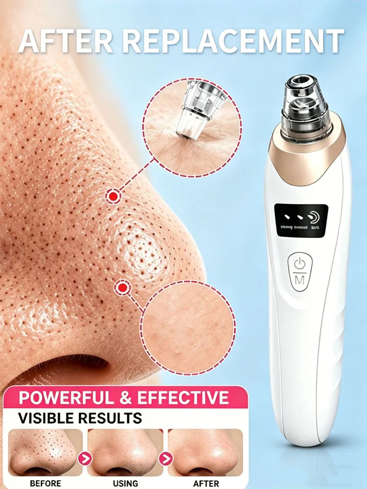 Rechargeable blackhead vacuum and pore extractor with LED display for effective facial cleansing and skin improvement.