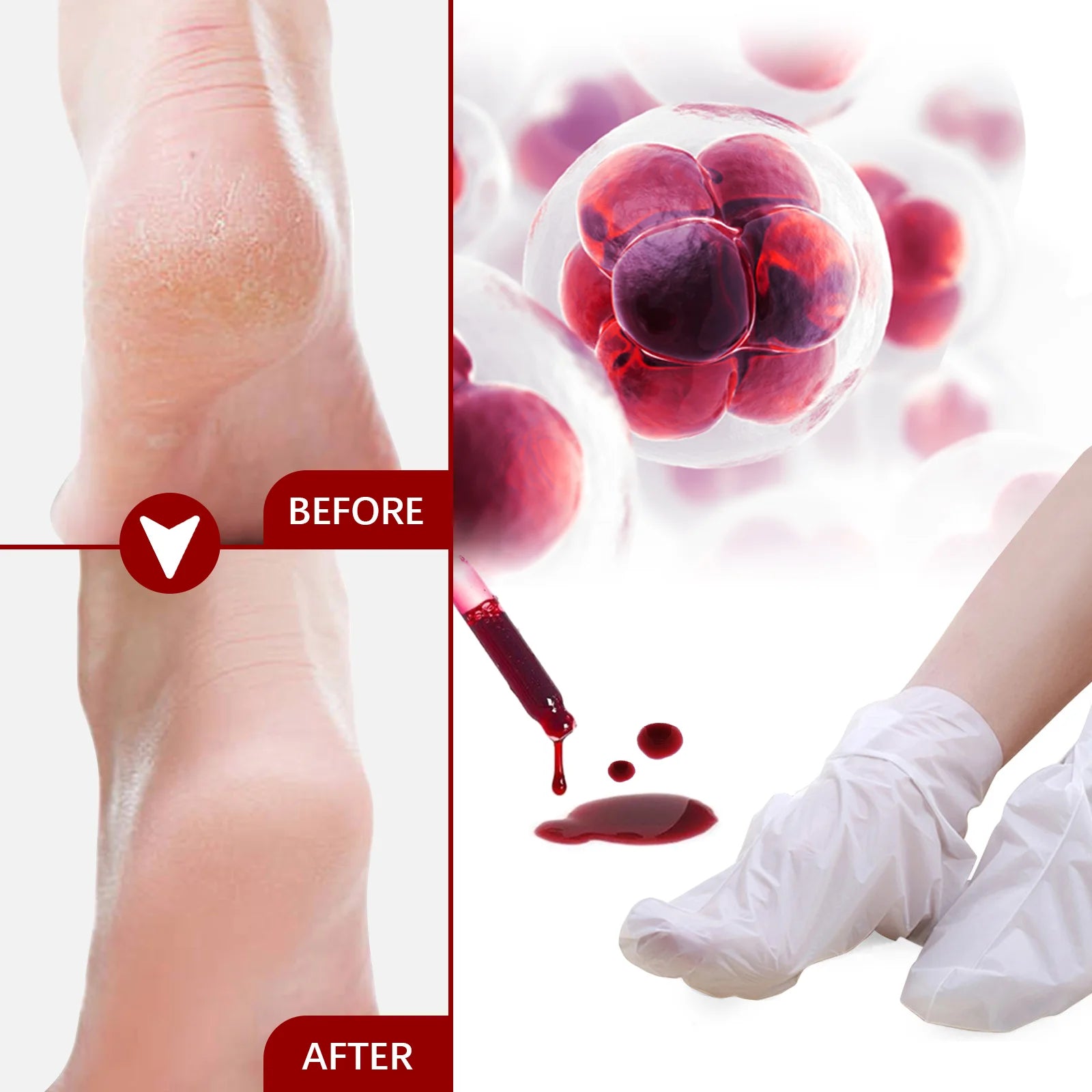 Exfoliating Foot Peel Mask - Apple Extract Callus Remover (5-15 Pack) Scrubs Treatments Tidesmit