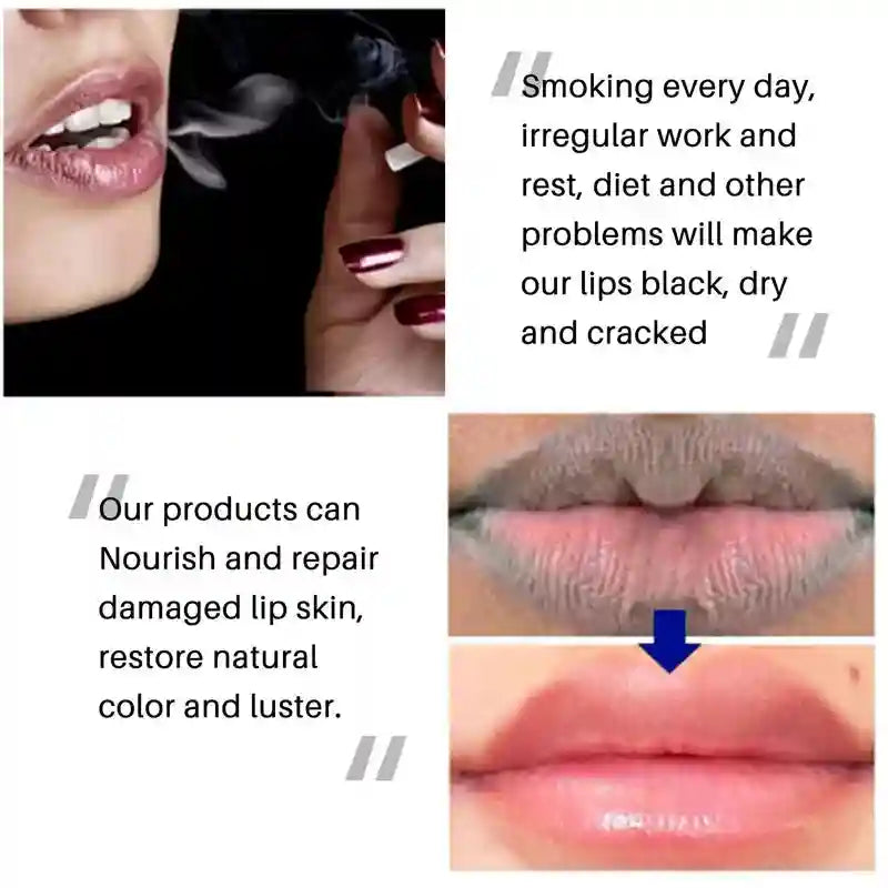 Dark Lip Lightening Balm | Exfoliating Treatment for Natural Pink Lips Lip Care Tidesmit