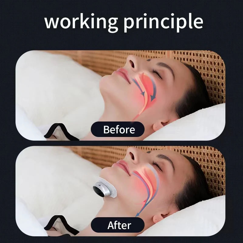 Anti Snoring Device Dual Pulse Throat Massager for Quiet Sleep Tidesmit