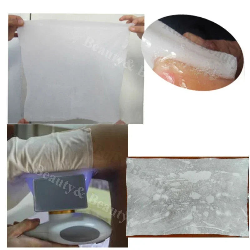 Antifreeze Membranes for Cryotherapy - 10 Pack 110g Professional Grade Scrubs Treatments Tidesmit