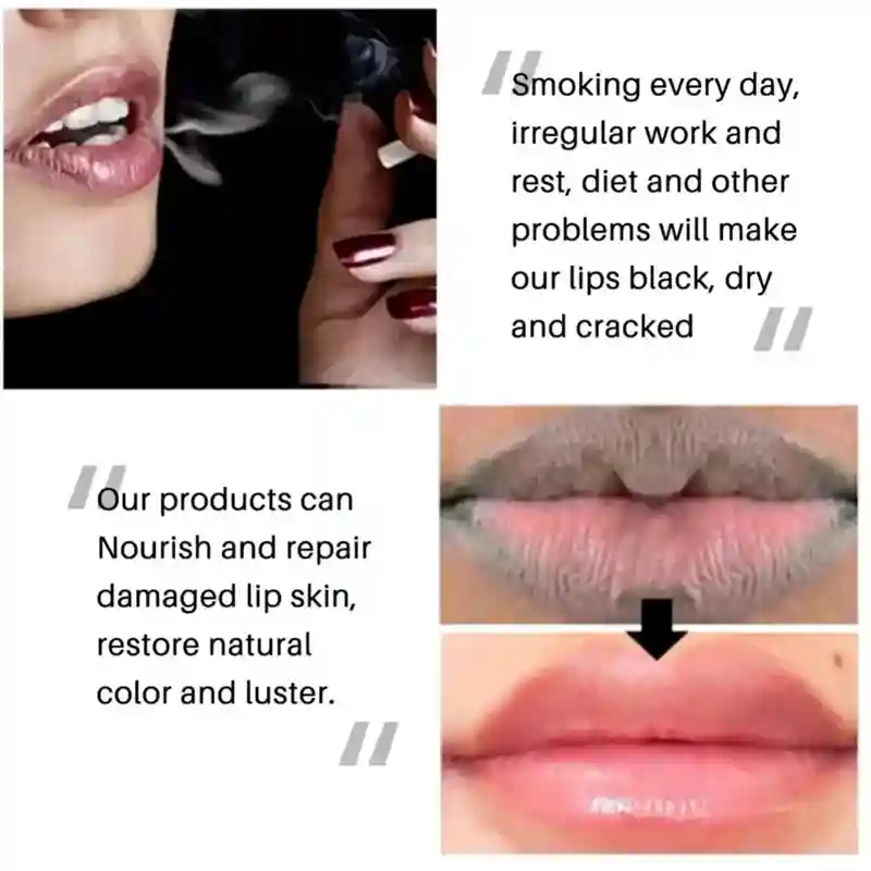 Lip Lightening Balm - Exfoliating Moisturizer for Dark Lips | Tidesmit Lip Care Tidesmit
