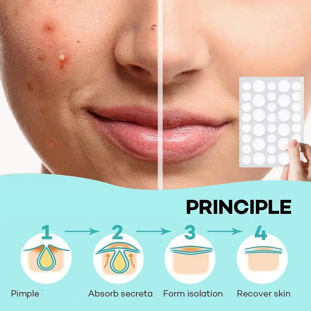 Invisible Pimple Patches for Face with Tea Tree Oil, 72/288 Counts Hydrocolloid Acne Pimple Patches Blemish Dots Patch Stickers