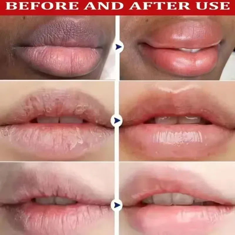 Dark Lip Lightening Balm | Exfoliating Serum for Natural Pink Lips 10g Lip Care Tidesmit
