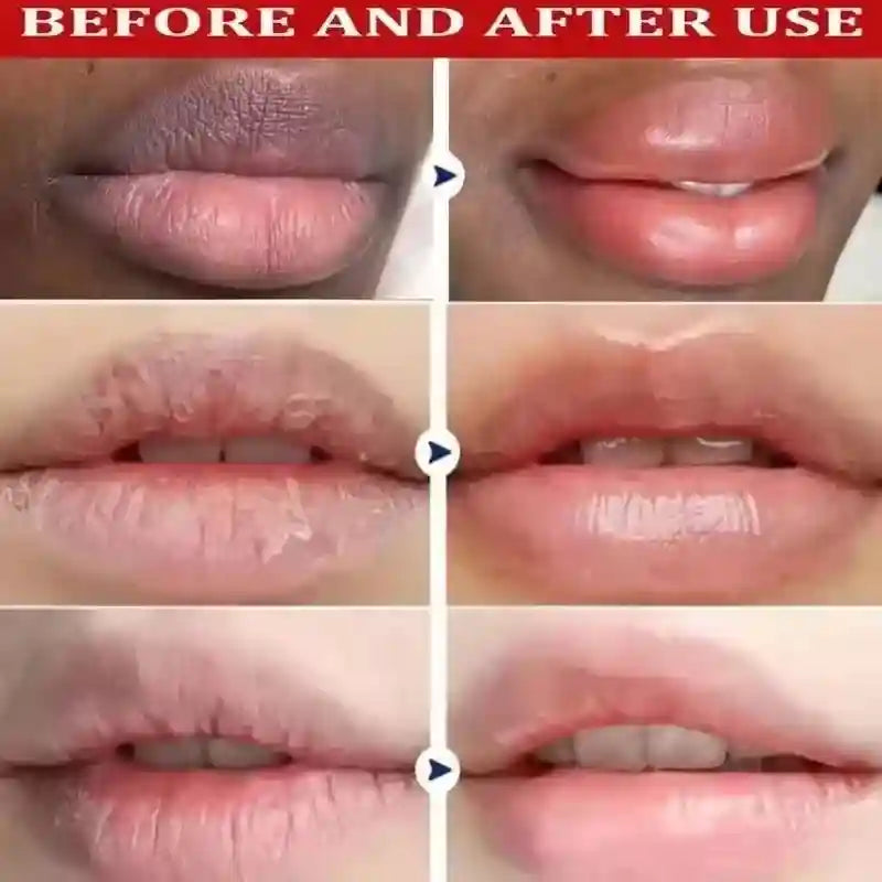 Dark Lip Lightening Mask | Exfoliating Lip Treatment Balm 10g Lip Care Tidesmit