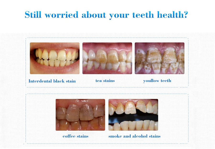 Tidesmit teeth whitening serum gel removing plaque and smoke stains for brighter smile and fresh breath