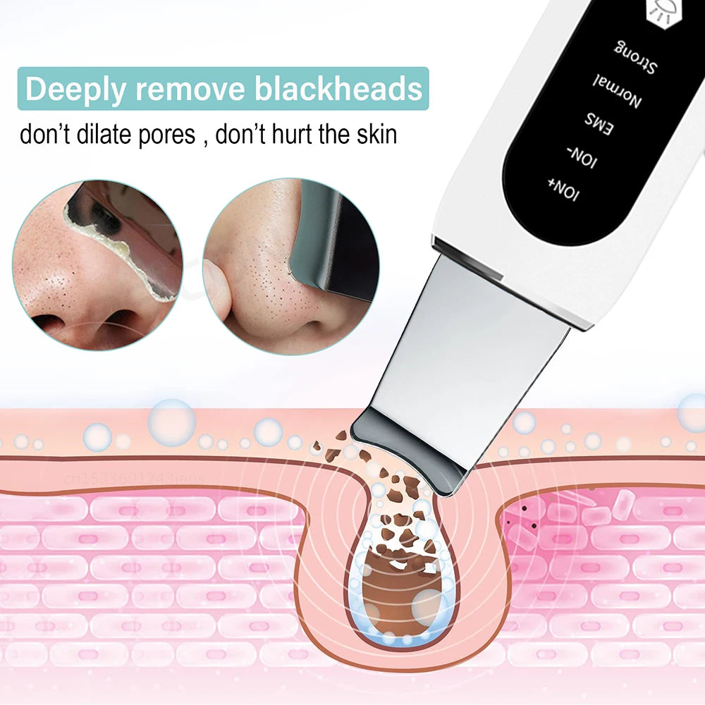 Ultrasonic Skin Scrubber – Professional Pore Cleansing Facial Tool Scrubs Treatments Tidesmit