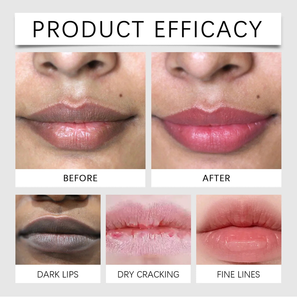 Lip Treatment Balm for Chapped Lips - Deep Hydrating Care by Tidesmit Lip Care Tidesmit